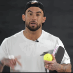 The #1 Mistake in Your Pickleball Block Volley (And How to Fix It)